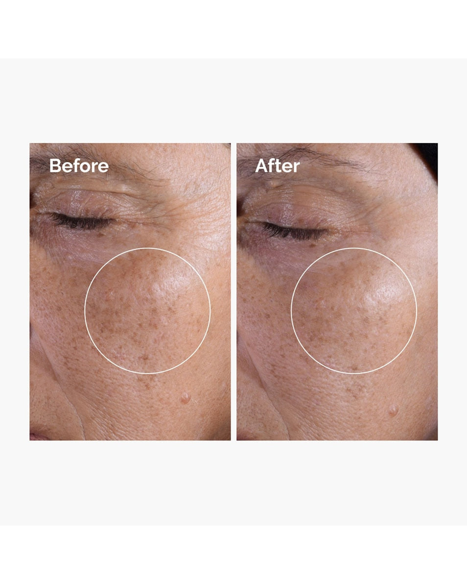 The Ordinary Glycolic Acid 7% Exfoliating Toner 240 ml