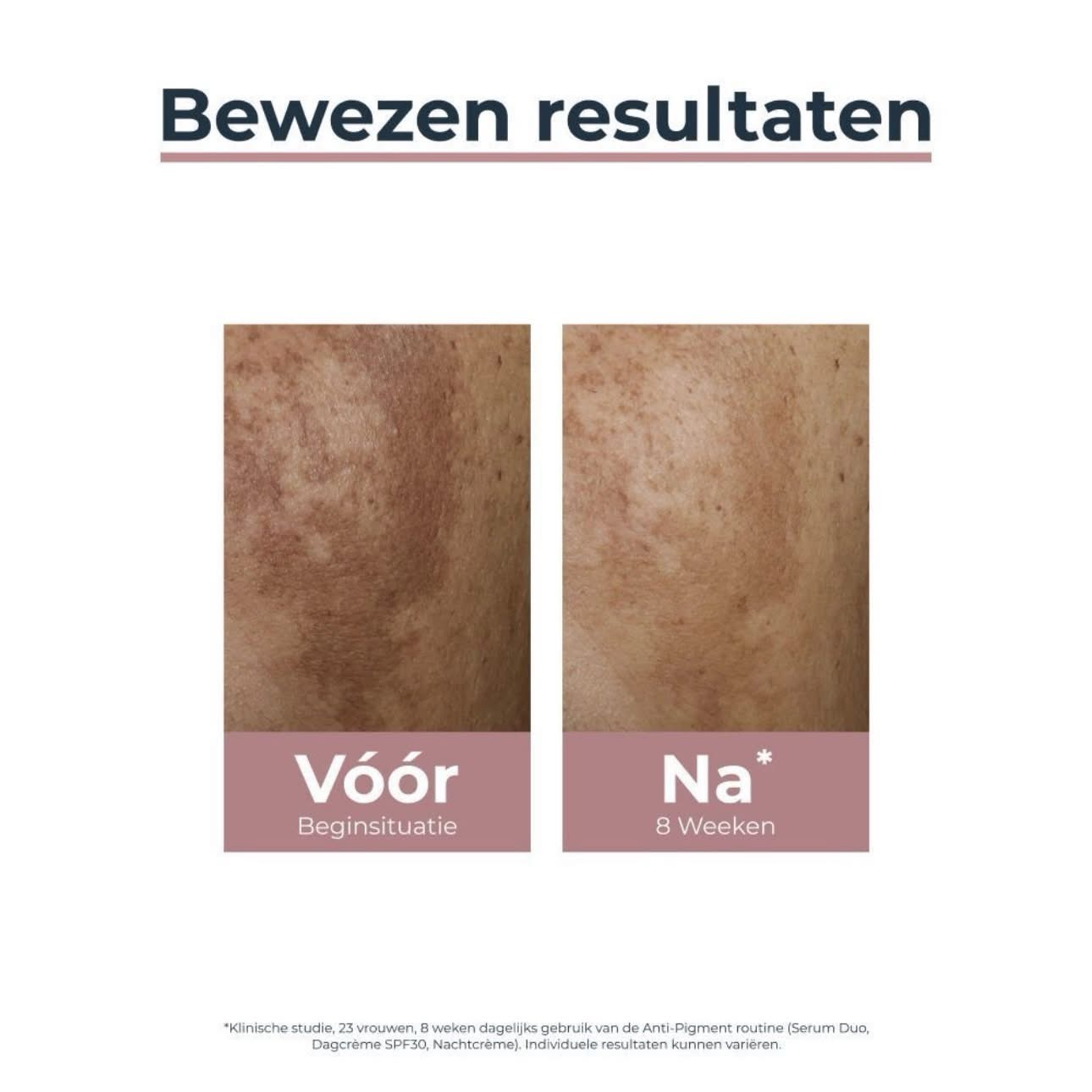 Eucerin Anti-Pigment Soin de Nuit – كريم يوسيرين الليلي المضاد للتصبغات — صورة 3