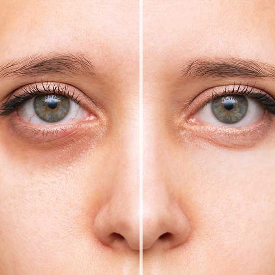 ISISPHARMA Neotone Eyes — صورة 3
