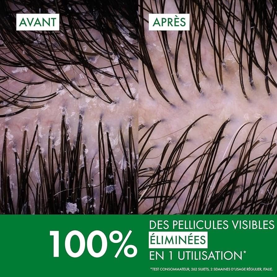 شامبو فيشي ديركوس المضاد للقشرة – Vichy Dercos Anti-Dandruff Shampoo — صورة 4